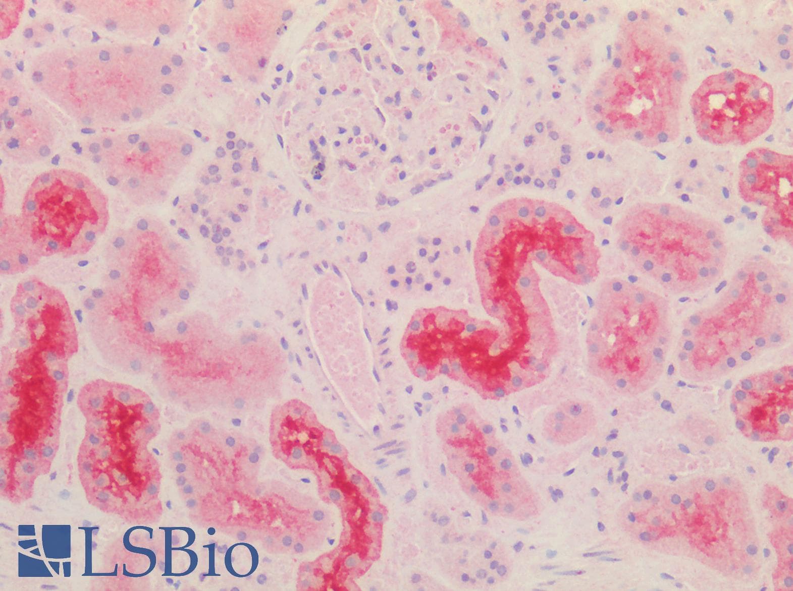 URAT1 / SLC22A12 Antibody