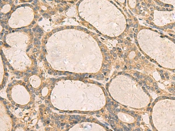 CXCL1 / GRO Alpha Antibody