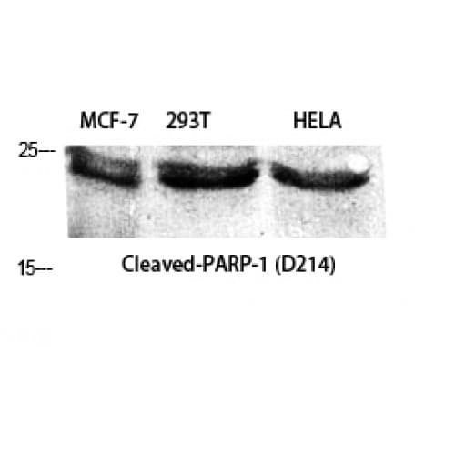 PARP1 Antibody (140-220 aa, Internal)