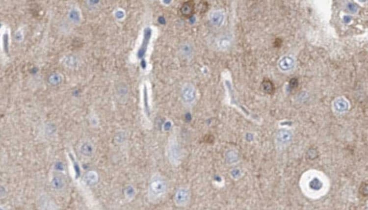 IL20RA Antibody