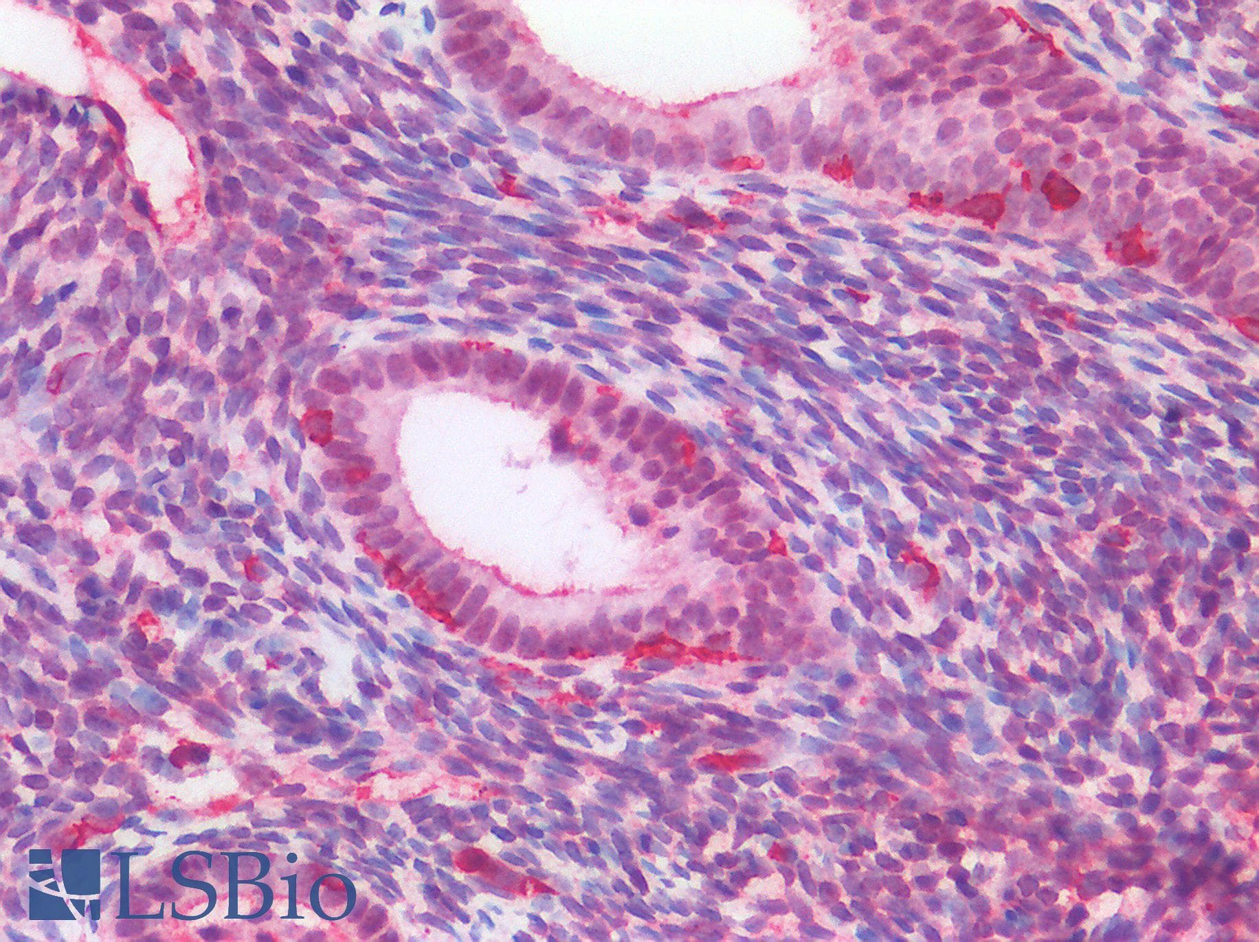 IHC-plus™ FOXC1 Antibody