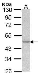 IHC-plus™ Polyclonal Rabbit anti-Human ACTG1 / Gamma Actin Antibody (IHC, WB)