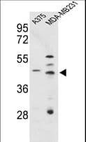 CTSD / Cathepsin D Antibody (aa377-408)