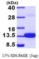 Human S100Z Protein (Recombinant His)