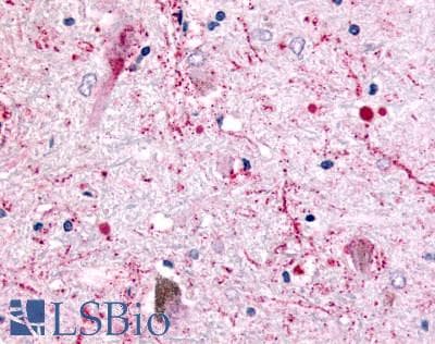 IHC-plus™ Polyclonal Rabbit anti-Human HTR4 / 5-HT4 Receptor Antibody (C-Terminus, IHC)