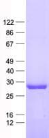 Human TNFSF5IP1 / CLAST3 Protein (Recombinant His, N-Terminal)