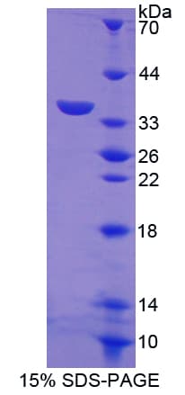 Mouse DEC-205 / CD205 / LY75 Protein (Recombinant His, N-Terminal)