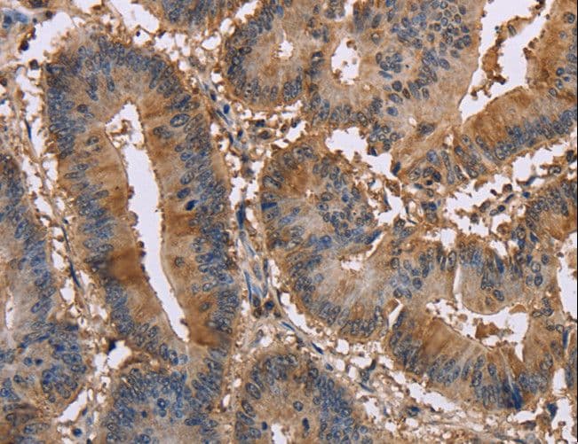 EDN2 / Endothelin 2 Antibody