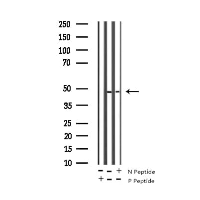 CXCR2 Antibody (phospho-Ser347)