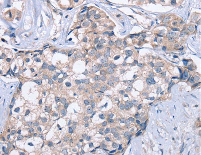KCNQ5 Antibody