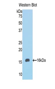KRT8 / CK8 / Cytokeratin 8 Antibody (aa399-483)