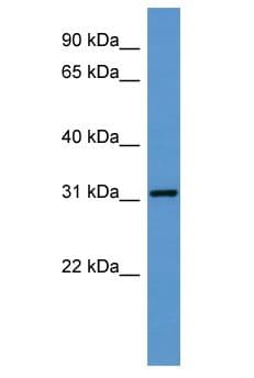 GTPCH1 / GCH1 Antibody (aa39-88)