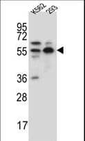Polyclonal Rabbit anti-Human NAE1 / APPBP1 Antibody (aa172-200, IHC, WB)
