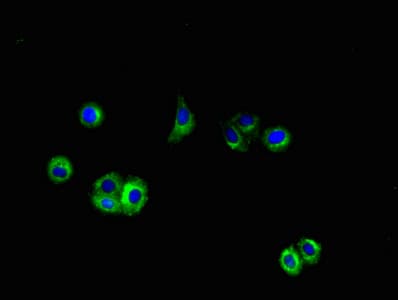 APP / Beta Amyloid Precursor Antibody (aa18-249)