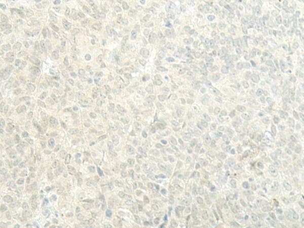Polyclonal Rabbit anti-Human ESRP2 / RBM35B Antibody (IHC)