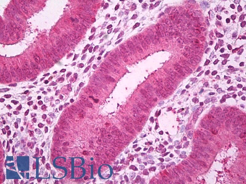 IHC-plus™ Polyclonal Rabbit anti-Human GALNT7 Antibody (IHC, WB)