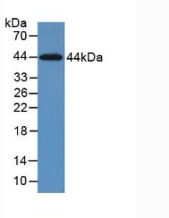 KRT5 / CK5 / Cytokeratin 5 Antibody