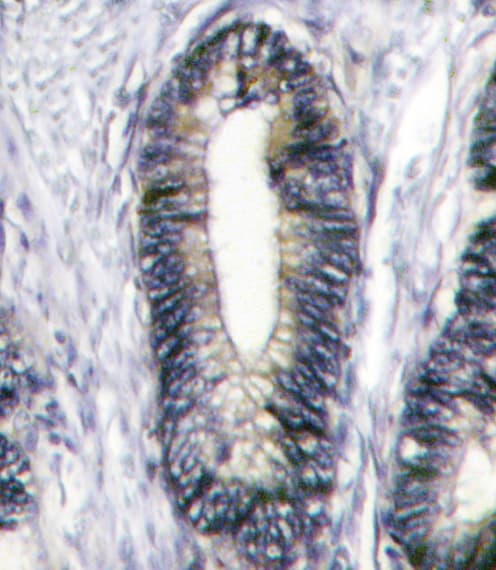 EPHB2 / EPH Receptor B2 Antibody (aa1021-1050)