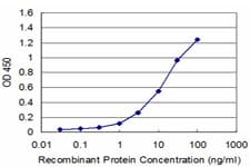 PLAG1 Antibody (clone 1F11)