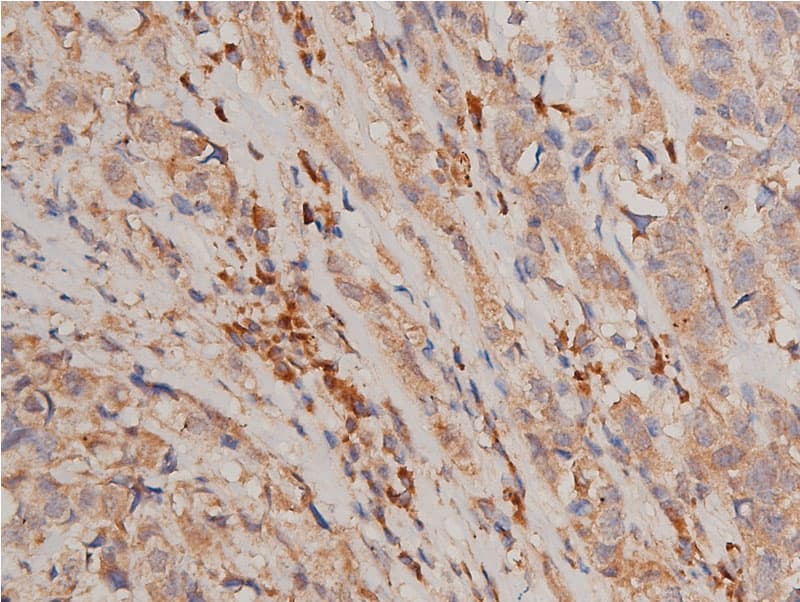 CHUK / IKKA / IKK Alpha Antibody (phospho-Ser176,pSer177)