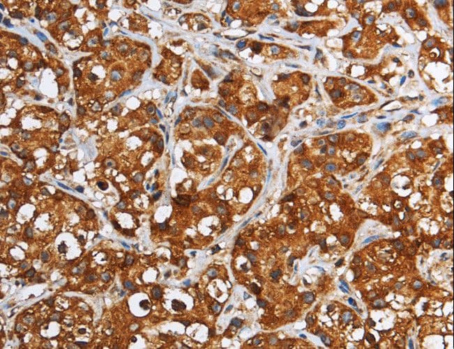 GGCX Antibody