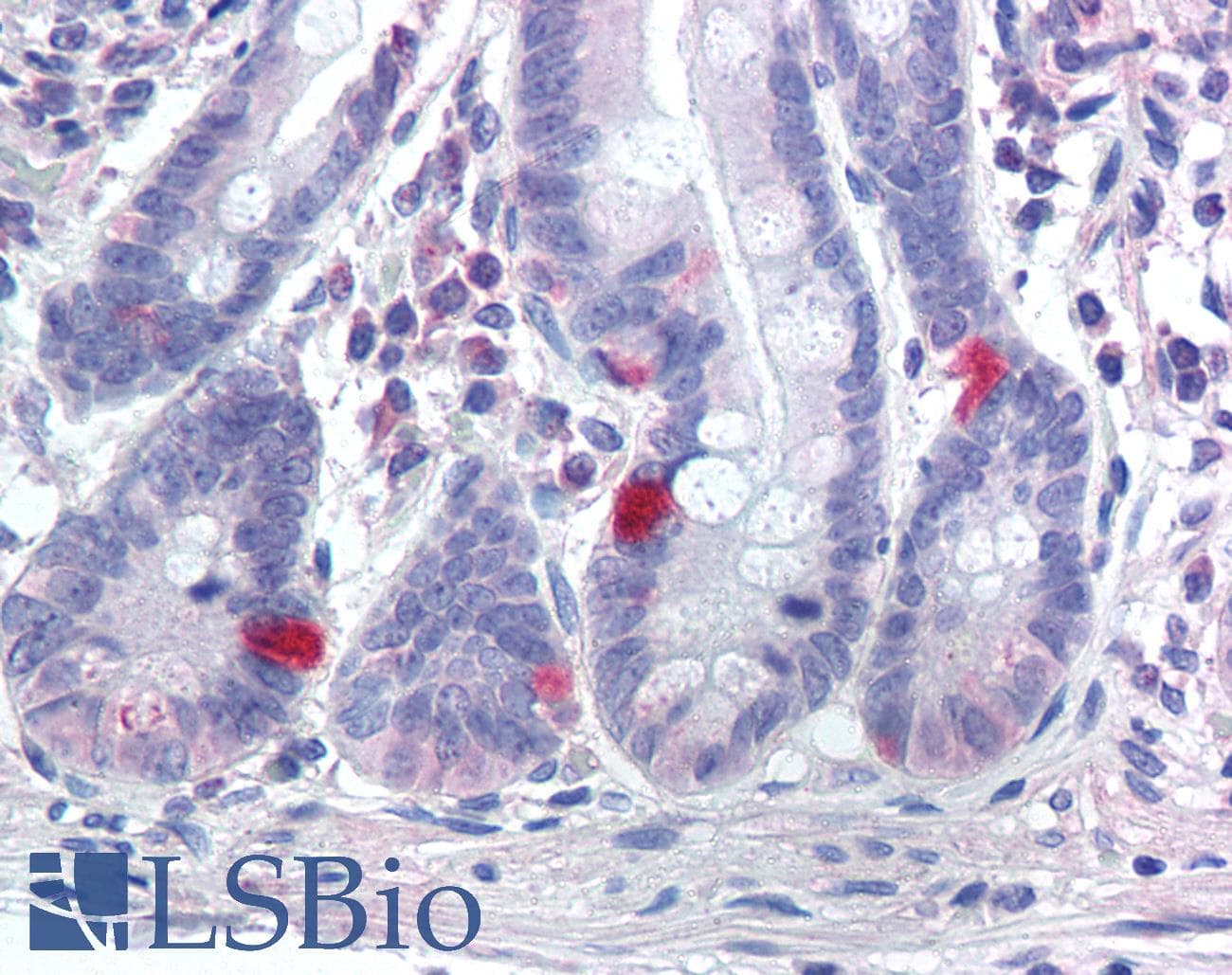 IHC-plus™ SCN9A / Nav1.7 Antibody (Internal)