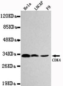 CDK4 Antibody