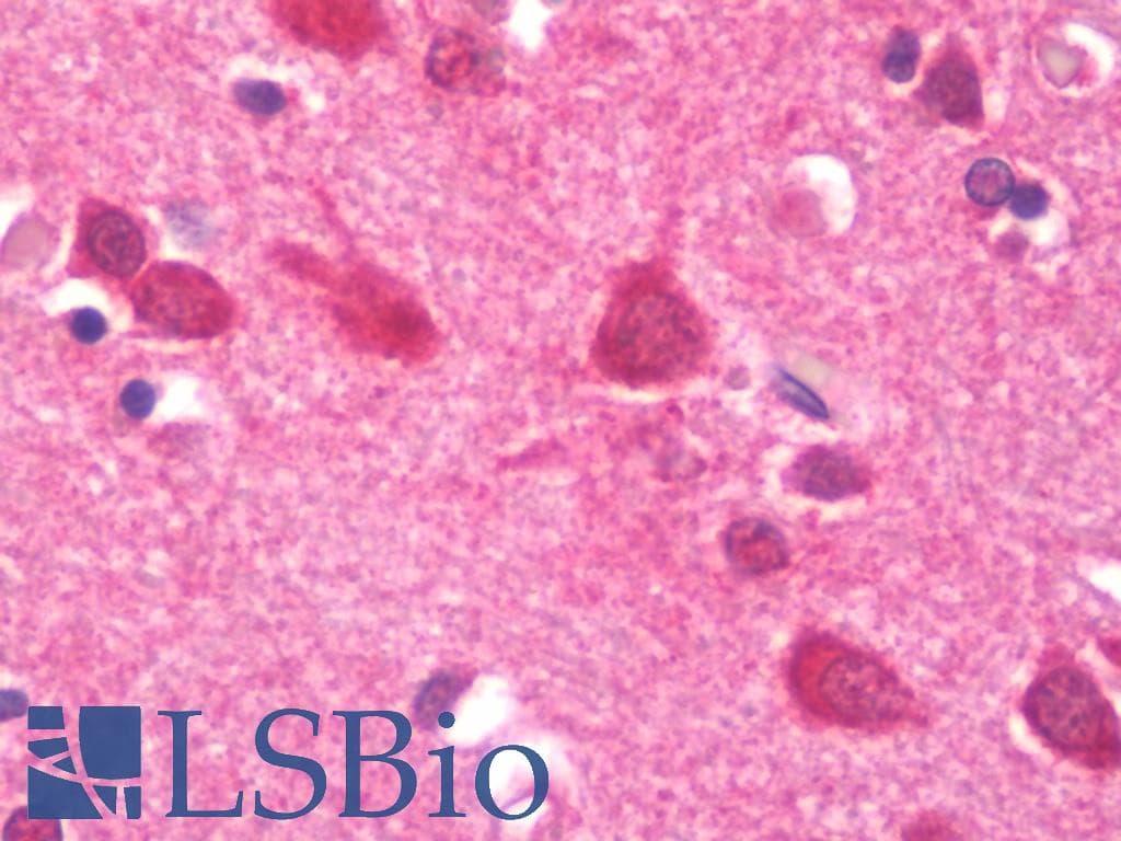 IHC-plus™ CIRP / CIRBP Antibody (clone 1C9)