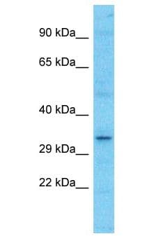 Polyclonal Rabbit anti-Human OR52N1 Antibody (aa226-275, WB)