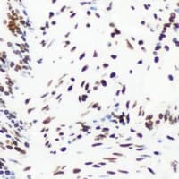 ESR2 / ER Beta Antibody