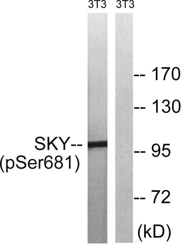 MER / MERTK Antibody (phospho-Tyr749/681)