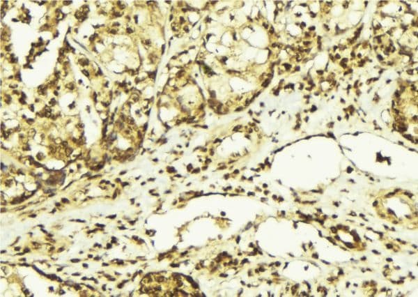 PRKDC / DNA-PKcs Antibody (phospho-Thr2647)