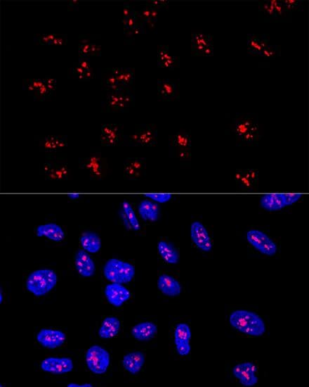 Polyclonal Rabbit anti-Human DDX21 Antibody (IHC, IF)