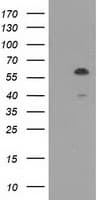 TCP11L2 Antibody (clone OTI3E4)