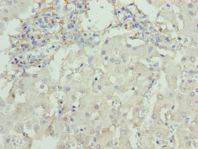Polyclonal Rabbit anti-Human DCX / Doublecortin Antibody (IHC)