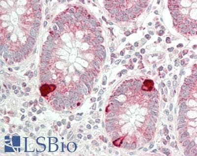 IHC-plus™ Polyclonal Rabbit anti-Human TSPAN9 Antibody (aa72-121, IHC, WB)