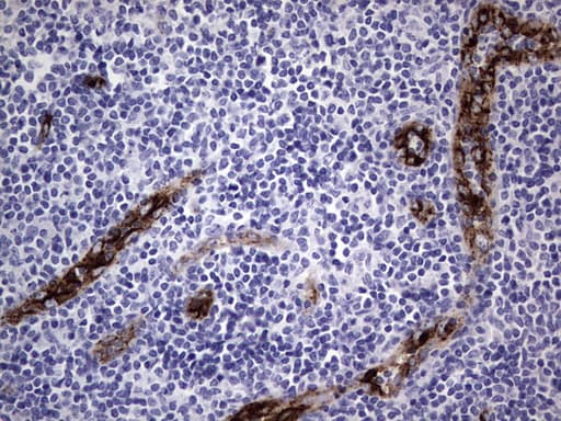 VWF / Von Willebrand Factor Antibody (aa764-1263, clone OTI7G3, Carrier-free)
