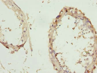 ZNF264 Antibody