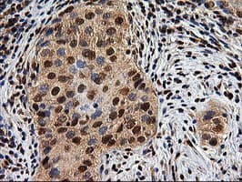 EPM2AIP1 Antibody (clone OTI1G9)