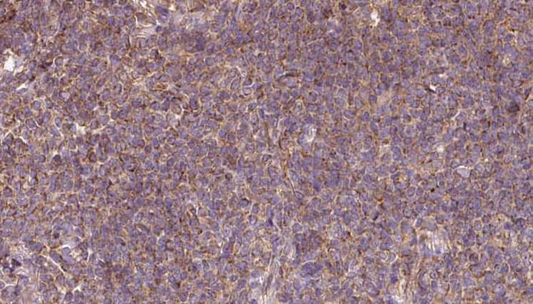 DNAJC10 Antibody