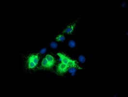 KCNJ3 / GIRK1 Antibody (aa279-501, clone OTI2E4, Carrier-free)