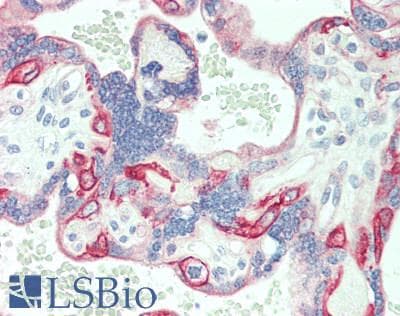 IHC-plus™ SLC7A5 / CD98 Light Chain Antibody (aa1-125)