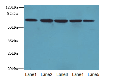 ILVBL Antibody