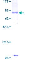 Human PCTK3 / CDK18 Protein (Recombinant GST)