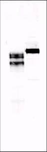 IHC-plus™ Polyclonal Goat anti-Human AHSG / Fetuin A Antibody (IHC, WB)