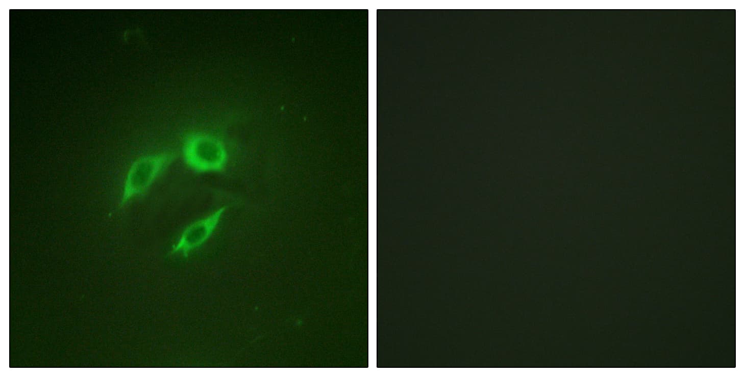 MAP2K4 / MKK4 Antibody (aa223-272)