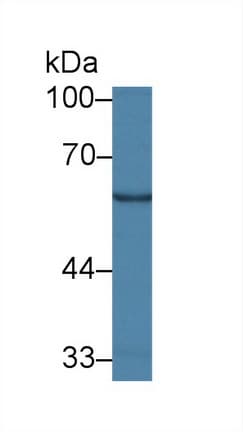GALC / Galactocerebrosidase Antibody (aa375-535)