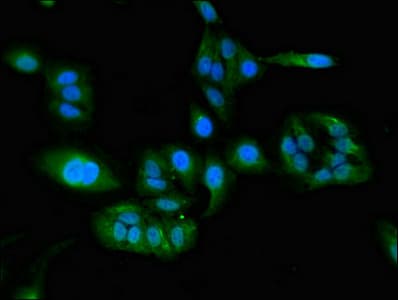 URP2 / FERMT3 Antibody