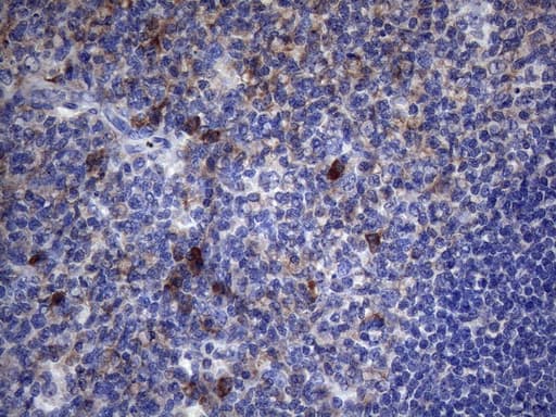 CRP / C-Reactive Protein Antibody (clone OTI6F3)