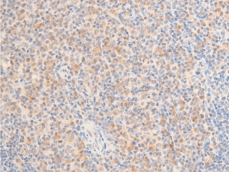 MAP3K7 / TAK1 Antibody (phospho-Thr187)